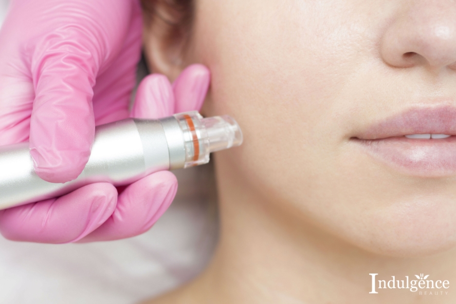 Micro-needling facial (MTS facial) facial treatment Singapore