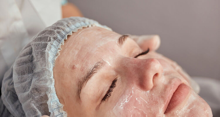 acne-facial-treatment-img
